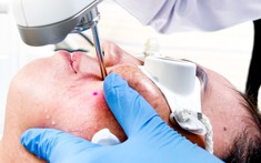 Dùng kem trắng da cấp tốc đón Tết, người phụ nữ 32 tuổi bị nổi mụn mủ, mặt đỏ ửng như say rượu