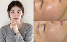Tôi đã tìm ra cách "bơm" collagen cho da căng mướt, tới độ không ai ngờ tôi đã 35 tuổi