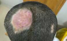 Cậu bé 6 tuổi hói vĩnh viễn vì nuôi thú cưng