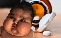 Ngày càng nhiều trẻ bị tác dụng phụ do dùng thuốc chứa corticoid: Dược sĩ chỉ rõ cách nhận biết corticoid trong đơn thuốc của con