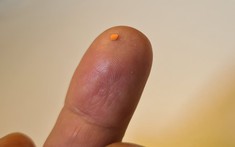 Vật thể chỉ 2mm làm nên điều kỳ diệu, giúp người mù đọc sách trở lại