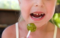 Bánh kẹo ngọt có phải là "thủ phạm" gây sâu răng sữa sớm ở trẻ