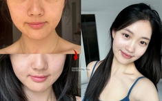 BTV chọn ra 5 sản phẩm làm trắng da, ngừa nám toàn diện ai dùng cũng mê