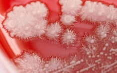 Người đàn ông "họng trắng như tuyết" vì thói quen này của nhiều người