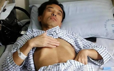 Người đàn ông 53 tuổi mắc ung thư gan, bác sĩ tức giận: Đừng làm việc này quá 3 lần 1 tháng