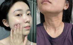 5 vùng da lão hóa nhanh nhất mà 90% chị em đều bỏ quên, nhìn vào dễ tưởng là người già