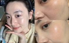 Cô gái từng sợ dầu dưỡng nay lại nghiện dùng, và làn da cô chứng minh điều đó!