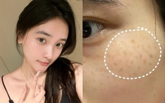 Không cần mỹ phẩm ngoại, đây là 5 kem dưỡng "made in Vietnam" làm mờ thâm, sáng da cực đỉnh