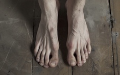 Không ho, không khó thở, người đàn ông 48 tuổi bị sưng chân đi bất ngờ khám phát hiện ung thư phổi giai đoạn 3: Bác sĩ cảnh báo nóng! 