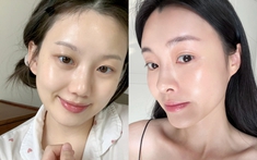 5 serum collagen đậm đặc giúp trẻ hóa làn da, nhan sắc thăng hạng