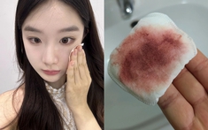 Không cần hàng ngoại, 5 nước tẩy trang "made in Vietnam" này vẫn làm sạch da cực đỉnh