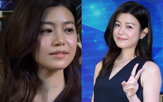 Tình trạng da khó tin của Trần Nghiên Hy 