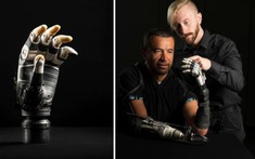 Kỹ sư Mỹ phát triển bàn tay sinh học tích hợp AI giúp người khuyết tật cầm nắm chính xác như tay thật