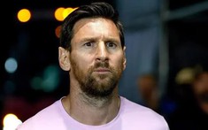 Messi gây bất ngờ
