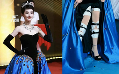 Cực hình đi thảm đỏ của mỹ nhân Cbiz