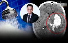 Phó Giám đốc bệnh viện Thái Lan cảnh báo 3 thói quen dễ gây đột quỵ vào mùa lạnh, người Việt hầu như đều mắc