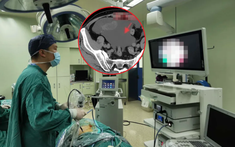 Nam thanh niên vấp ngã vỡ bàng quang, nguyên nhân từ loại đồ uống yêu thích của nhiều nam giới