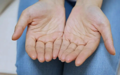 Nam giới mắc bệnh thận, thường xuyên ra mồ hôi ở 5 vị trí này