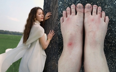 Lý Nhã Kỳ bị kiến độc cắn khi đi chụp ảnh