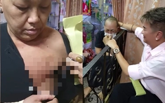 Nữ ca sĩ bị ung thư di căn chỉ còn 500 ngàn, Đàm Vĩnh Hưng cầm 100 triệu tới tặng luôn