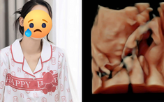 Mẹ bầu Vbiz ám ảnh sau khi làm xét nghiệm: Bị choáng váng đầu óc, nằm 2 tiếng không thở nổi