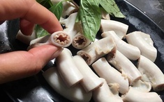 Bác sĩ cảnh báo 5 nhóm bệnh lý nguy hiểm, càng ăn lòng se điếu bệnh sẽ càng nặng hơn