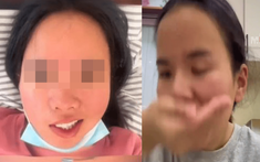 Cô gái 25 tuổi liệt mặt sau 3 ngày duy trì 1 thói quen ban đêm của nhiều người