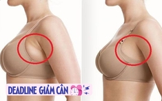 Phụ nữ sau tuổi 40 có nhiều mỡ nách chỉ cần 1 chiếc dây để thực hiện 6 động tác: Đảm bảo sớm gọn đẹp như được hút mỡ nách