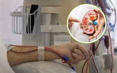 Người trẻ bị suy thận ngày càng cao: “Nằm lòng” 3 lời khuyên từ bác sĩ để dự phòng sớm căn bệnh này!