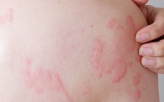 Bác sĩ chỉ ra sai lầm “chết người” về một căn bệnh mà nhiều người vẫn vô tư điều trị hi88.com nhà