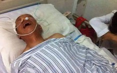Ngày càng nhiều người tử vong vì nhồi máu não? Bác sĩ khuyên: Uống nước nóng còn hơn ăn 4 thứ này