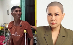 Nghệ sĩ hài được link bong da truc tiep cho 20 triệu: Lâm cảnh bần cùng, trắng tay vì bệnh tật