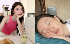 7 thói quen tai hại và phổ biến khiến nhà cái hi88 nhanh chảy xệ, lão hóa