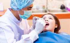 Đừng để nướu “kêu cứu”: Bí quyết chăm sóc nướu đúng cách