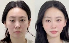 Cái giá của nhan sắc: Phẫu thuật hay chăm sóc tự nhiên?