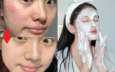 Thay đổi cách rửa mặt, lỗ chân lông của tôi nhỏ hẳn lại và da "đẹp lên trông thấy"
