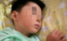 Bé trai 6 tuổi tử vong vì "amip ăn não" sau khi chơi dưới nước