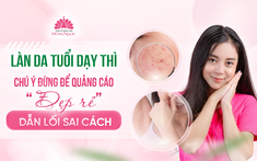 Làn da tuổi dậy thì - Chú ý đừng để quảng cáo "đẹp rẻ" dẫn lối sai cách
