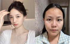 5 tuýp kem mắt dưới 400k nhận được đánh giá 4,9/5* từ nhiều người dùng