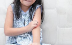 Đừng để ký sinh trùng âm thầm hủy hoại cơ thể - Xét nghiệm sớm tại DIAG