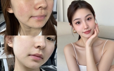 5 lọ toner đa chức năng: Rất phù hợp dùng khi thời tiết chuyển mùa