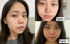 7 tháng tự dưỡng trắng da tại nhà, cô nàng nhận kết quả không thể mỹ mãn hơn