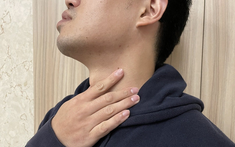 Uống 5 lon nước ngọt mỗi ngày, nam thanh niên trào ngược dạ dày 98 lần