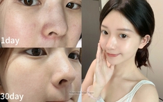 Không chạy theo xu hướng da "trắng sứ", tuổi 35+ tôi nhận ra rằng chỉ cần dưỡng đúng cách thì da sẽ sáng mịn từ bên trong