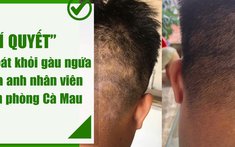 Icare Pharma: Hành trình tận tâm đồng hành cùng người Việt thoát khỏi nỗi lo gàu ngứa