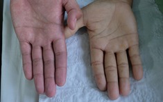 lich bong da truc tiep bệnh lý nguy hểm không chừa lich bong da truc tiep ai: từ trẻ em, phụ nữ đến người làm văn phòng!
