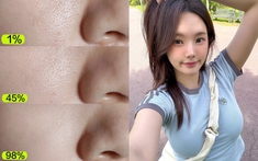 7 cách thu nhỏ lỗ chân lông cho da căng mướt dù đã qua 30 tuổi