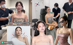 Rộ trào lưu tiêm vai móc áo giống Jennie