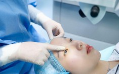 Mổ cận rồi có tái cận lại không và làm cách nào để "phòng bệnh hơn chữa bệnh"?