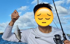1 nam ca sĩ gây sốc khi tiết lộ não bị biến dạng nghiêm trọng